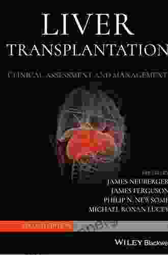 Liver Transplantation: Clinical Assessment And Management